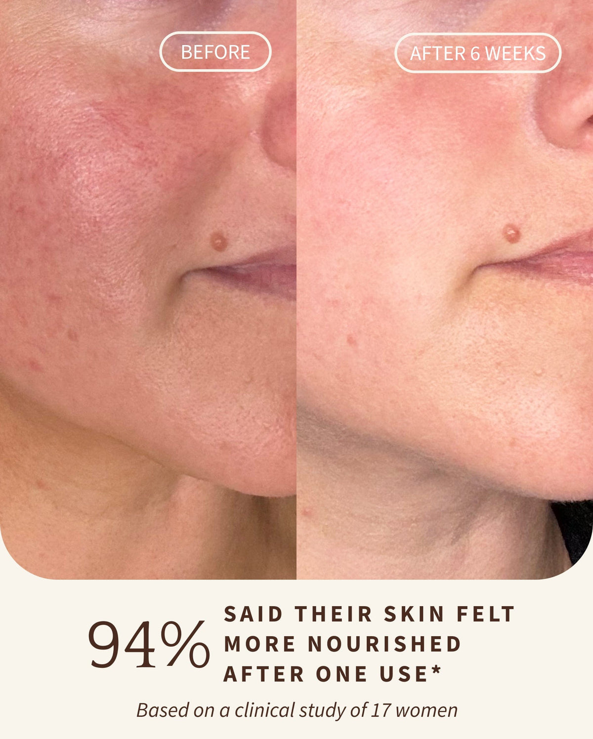 Bambu Earth Activated Charcoal Cleansing Oil - Before-and-after split comparison of a woman's lower face showing skin