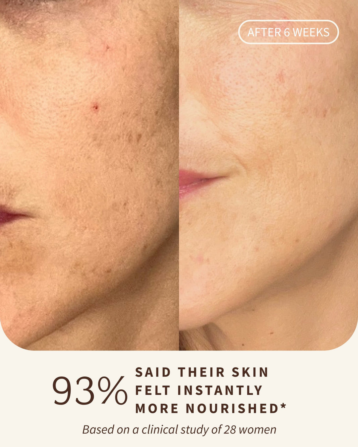 Bambu Earth Helichrysum Hydration Facial Mist - Before and after comparison of skin nourishment with text indicating 93% of
