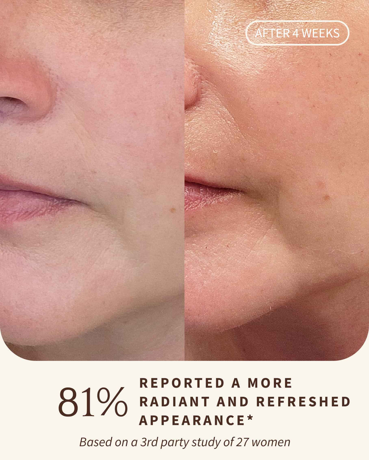 Bambu Earth Papaya Enzyme Exfoliating Mask - Before and after comparison of skin texture on a person's face with text