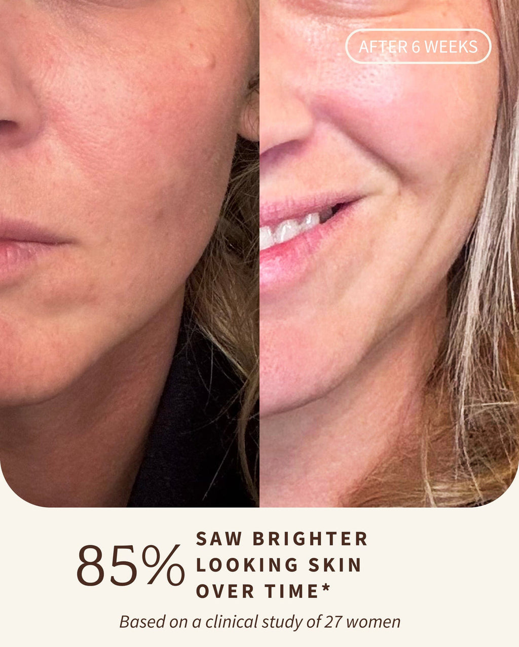 Bambu Earth Rosehip Repairing Facial Serum - Before and after comparison of a woman's face with text indicating 85%
